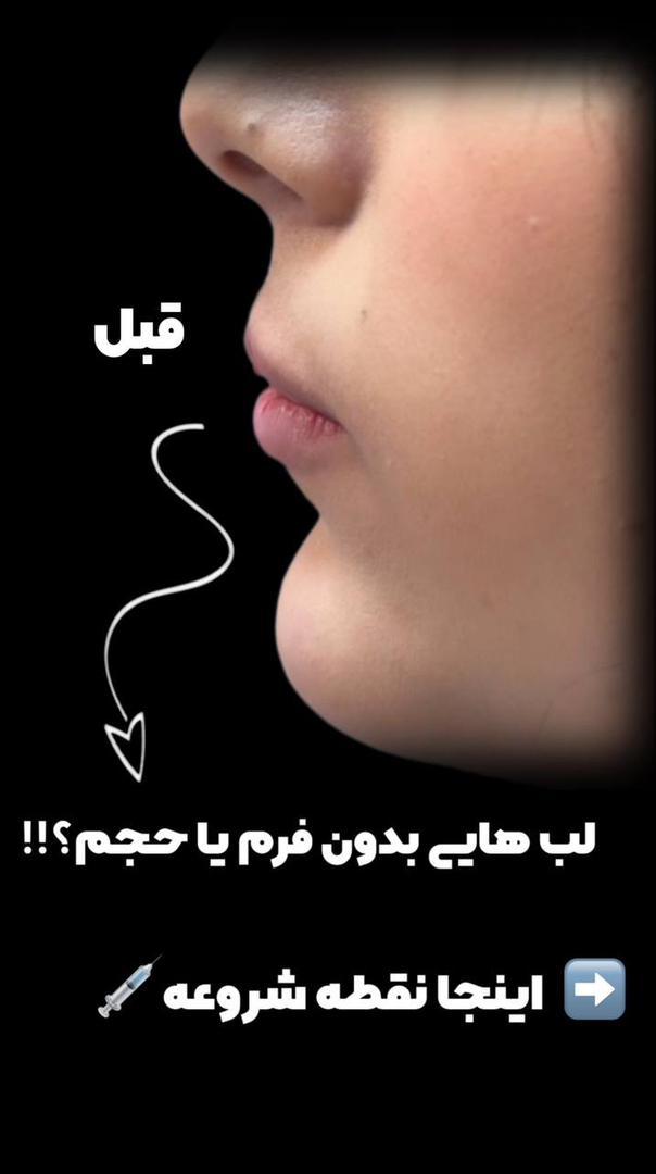 profile